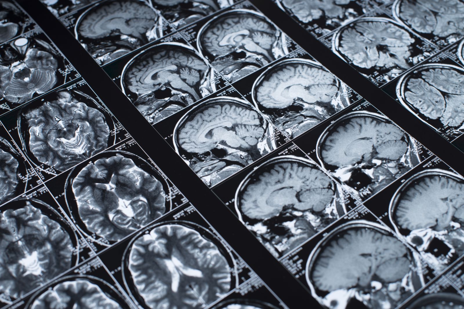 Neuroplastizität: Wie Fokus und Schlaf das Gehirn umbauen – Gehirn